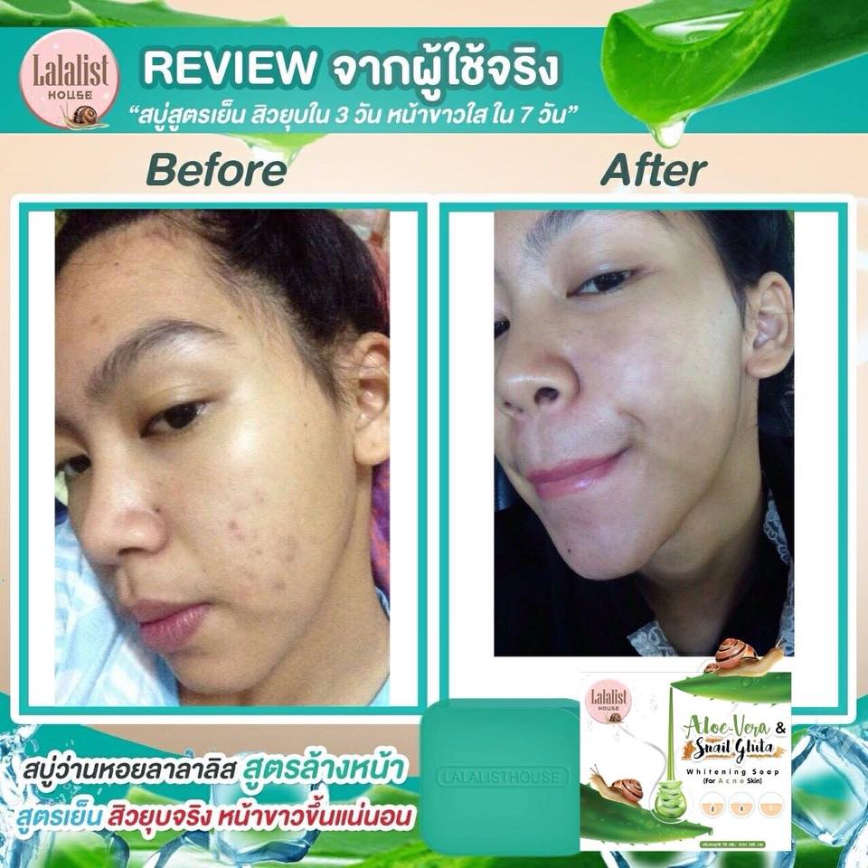 Aloe Vera & Snail Gluta Whitening Soap